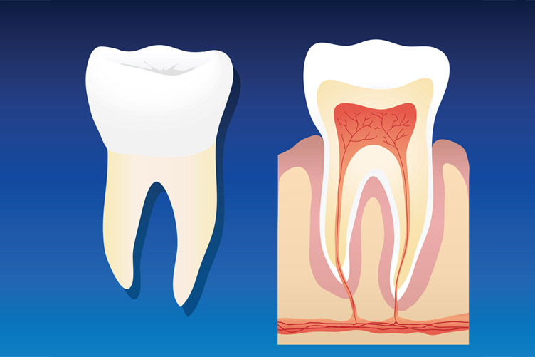 root canal edmonton